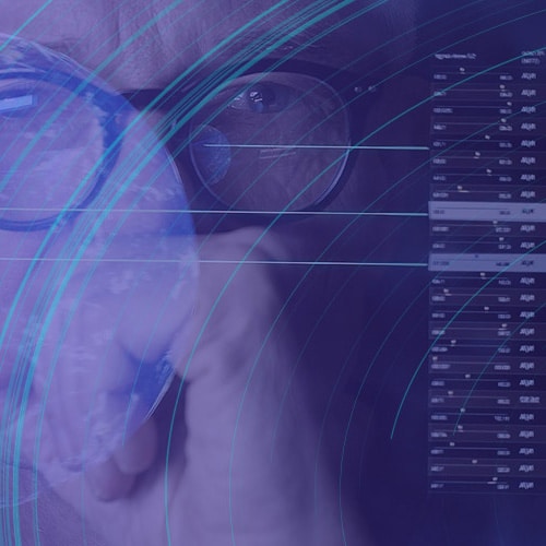 Only 4% of Senior IT Budget Leaders Are Highly Satisfied With AI Cost and ROI Tracking